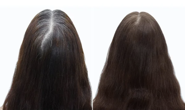 Resurgens Studio Luxembourg | Micro-pigmentation | Densification Femme