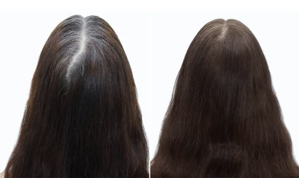 Resurgens Studio Luxembourg | Micro-pigmentation | Densification Femme